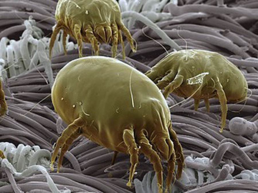 1324084120-dust+mite+3.jpg-scaled