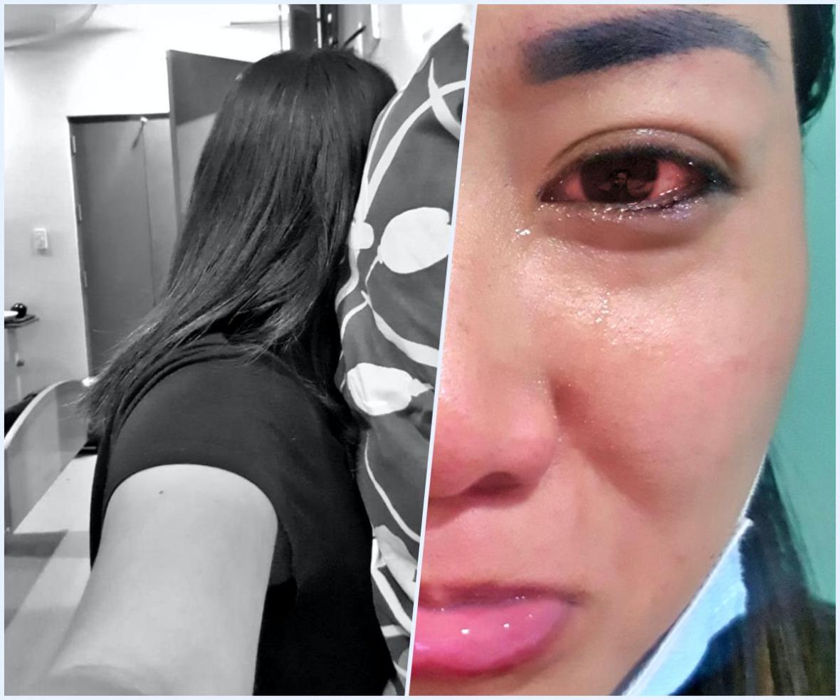 appendectomy philippines