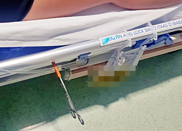 appendectomy philippines