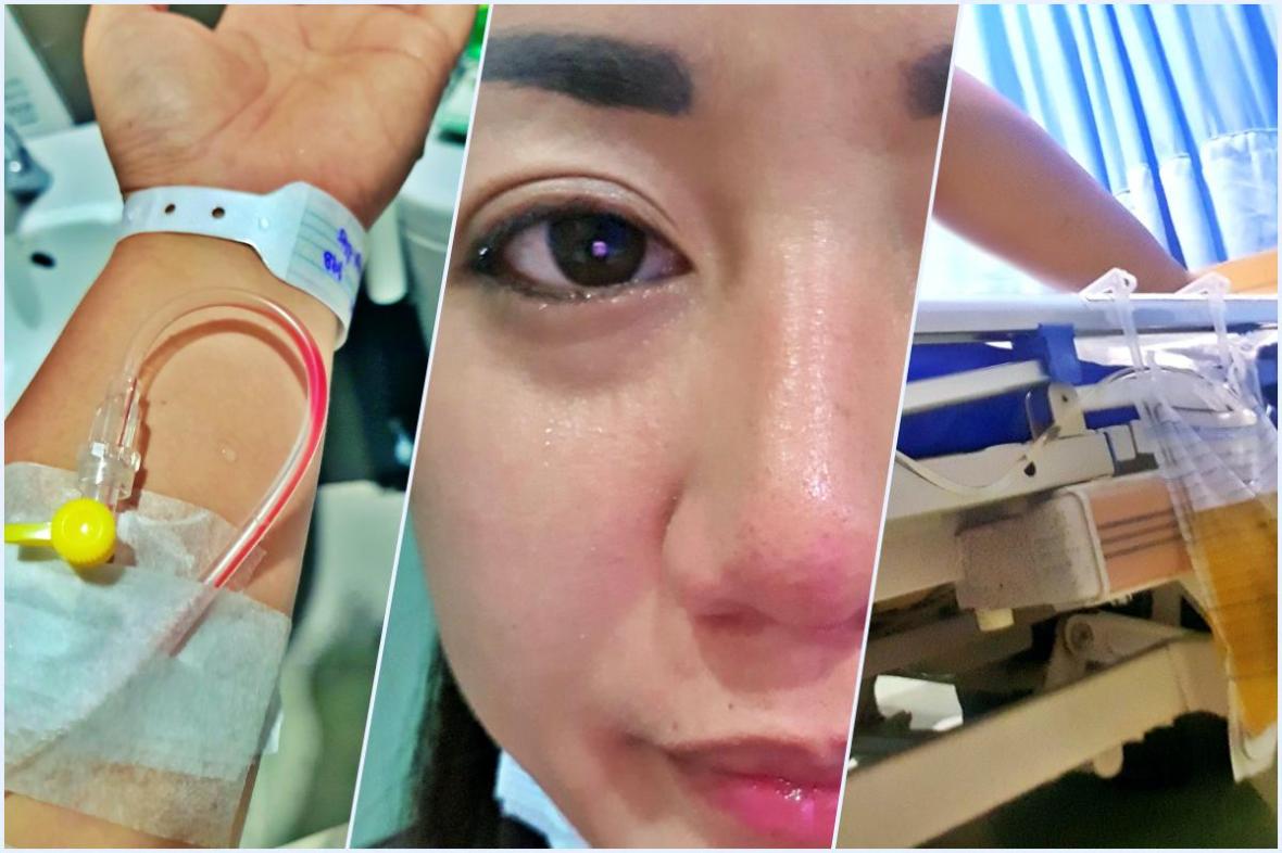 appendectomy philippines