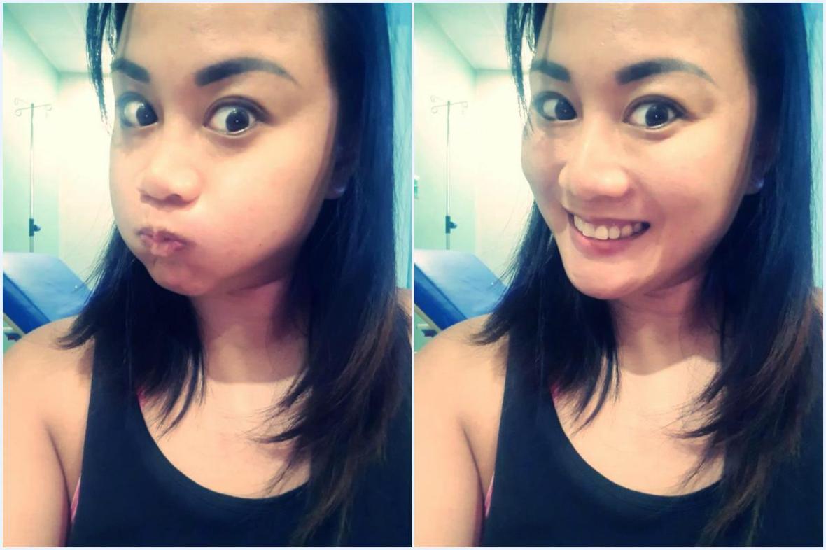 appendectomy salubris